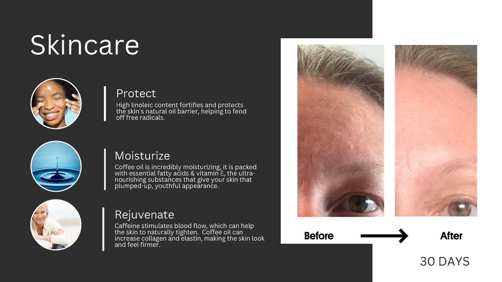 Apply twice a day to clean skin